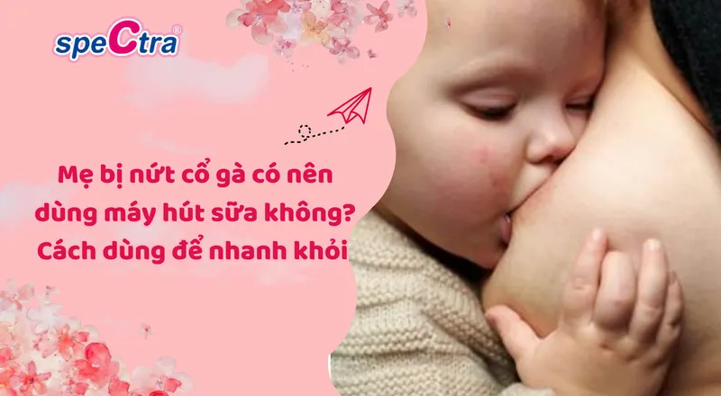 Sản phẩm 193d4c19 4c4d 49fd 9bbe 0de001f7a170 — Công Ty Cổ Phần Dịch Vụ Vietlife — MST 0103747587
