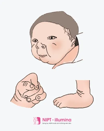 Sản phẩm các hội chứng 02 — Công Ty Cổ Phần Dịch Vụ Phân Tích Di Truyền — MST 0104964175