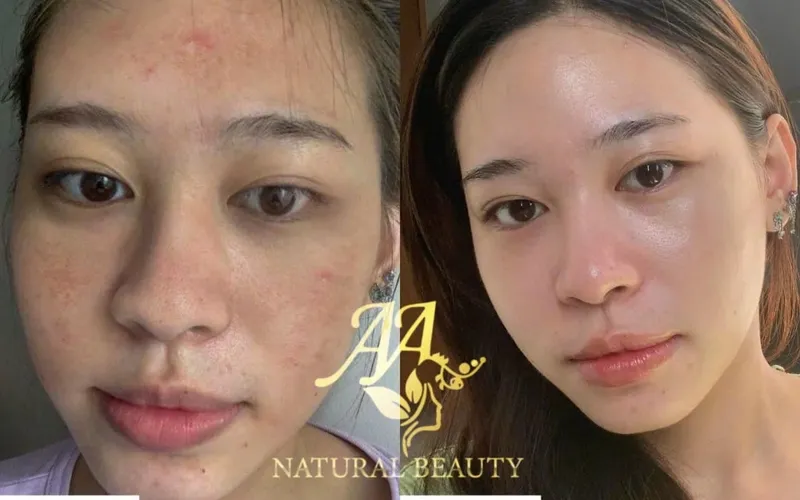 Sản phẩm 434743575_383217367944150_502413678558974259_n_1715225347 — Công Ty Cổ Phần Hoàng Ngọc Thảo — MST 0105117492