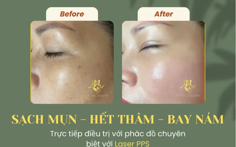 Sản phẩm hyperpigmentation treatment_1715225563 — Công Ty Cổ Phần Hoàng Ngọc Thảo — MST 0105117492