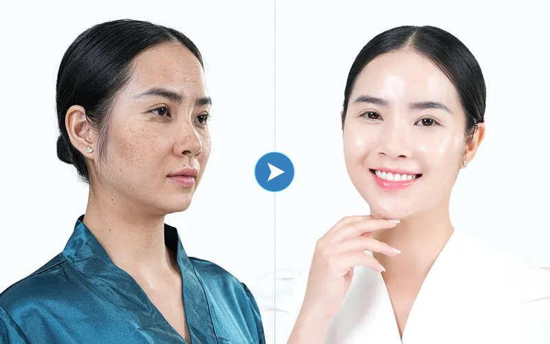 Sản phẩm imresizer 1701405200396_1701405741 — Công Ty Cổ Phần Hoàng Ngọc Thảo — MST 0105117492
