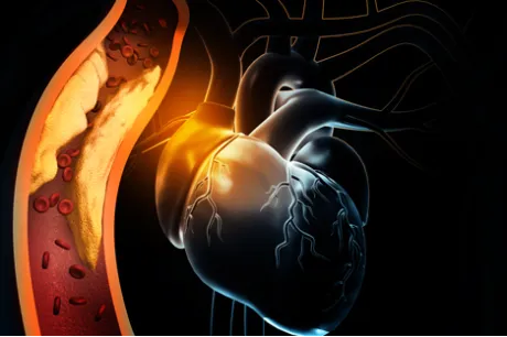 Sản phẩm CHD 281123 460x306 — Bác Sĩ Tim Mạch — MST 0105840045