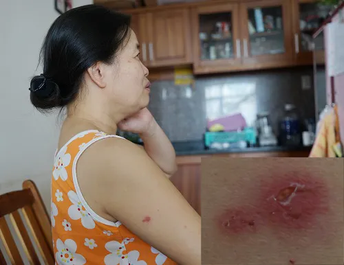 Sản phẩm 180102070619kien 3 khoang1 7260 1443672255 — Dịch Vụ Diệt Côn Trùng Hà Nội - Công Ty TNHH Diệt Mối Và Côn Trùng Hà Nội — MST 0106107289