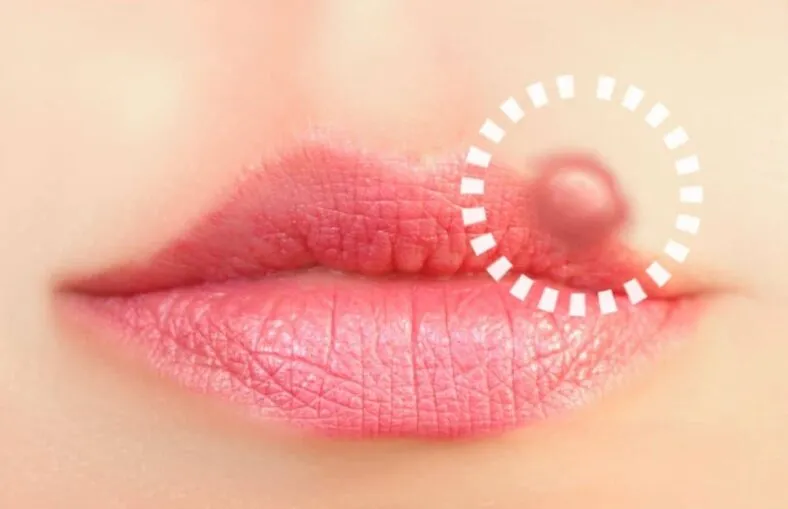 Sản phẩm mouth stds 788x509 — Cân Thăng Long - Công Ty TNHH Cân Điện Tử Thăng Long — MST 0106742883