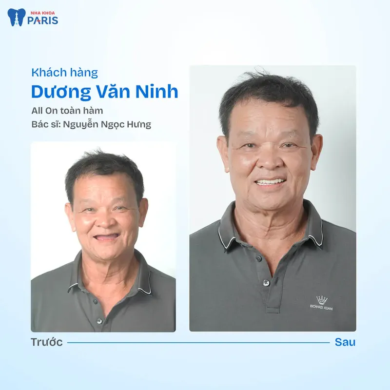 Sản phẩm kh duong van ninh.jpg — Nha Khoa Paris — MST 0107473432