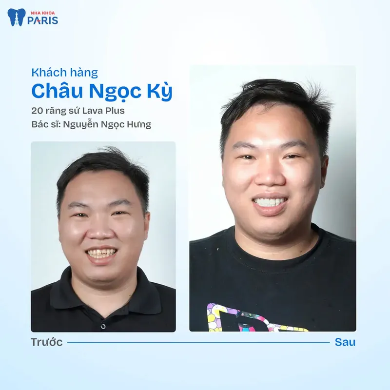 Sản phẩm kh ngoc ky.jpg — Nha Khoa Paris — MST 0107473432