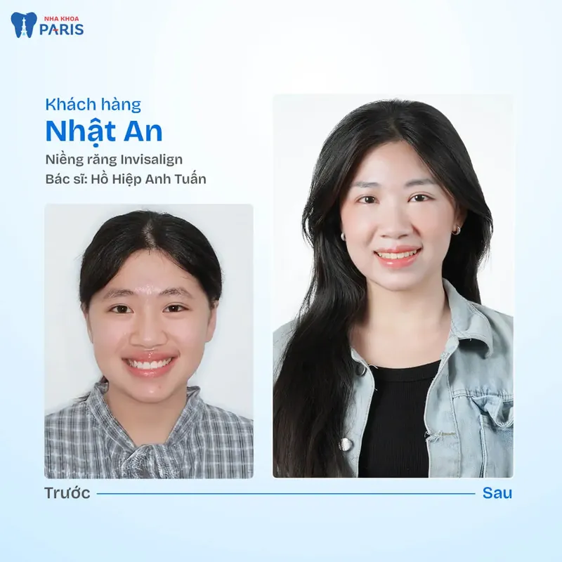 Sản phẩm kh nhat an.jpg — Nha Khoa Paris — MST 0107473432