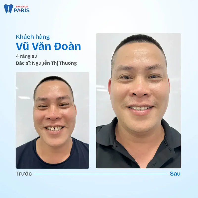 Sản phẩm kh van doan.jpg — Nha Khoa Paris — MST 0107473432