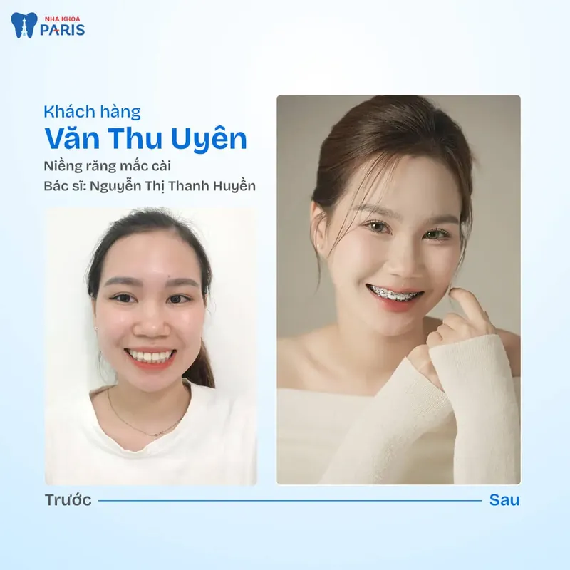 Sản phẩm kh van thu uyen.jpg — Nha Khoa Paris — MST 0107473432