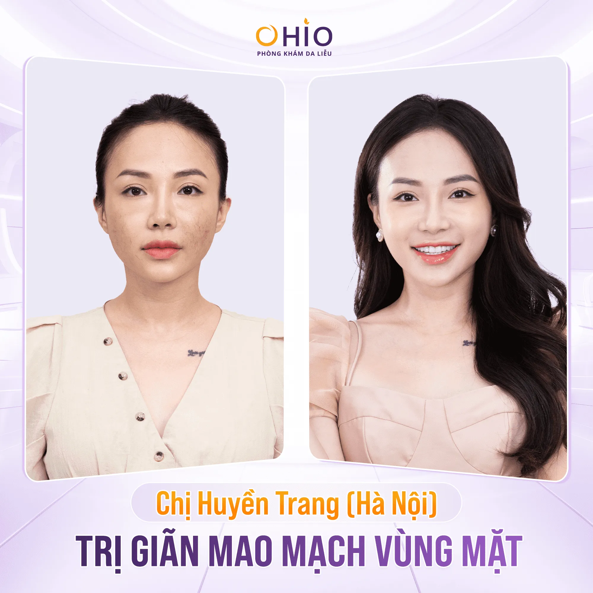 Sản phẩm BA trang chu — Công Ty Cổ Phần Thẩm Mỹ OHIO — MST 0107475246