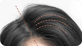 Sản phẩm 17 — Phòng Khám Cấy Ghép Tóc Y Học Quốc Tế — MST 0108360583