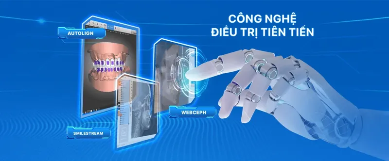 Sản phẩm nieng rang lac viet intech nha khoa lac viet 8 1400x581 — Nha Khoa Lạc Việt Intech — MST 0108432340