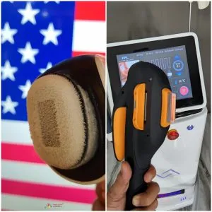 Sản phẩm may triet long ipl va diode laser 3 300x300 — Chi Nhánh Công Ty TNHH Domestic Việt Nam — MST 0108676153