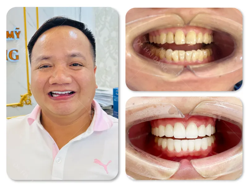 Sản phẩm Anh Manh — Phòng Khám Nha Khoa Hải Đăng — MST 0108780644