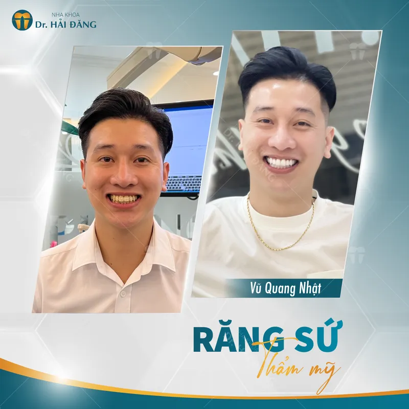 Sản phẩm Vu Quang Nhat — Phòng Khám Nha Khoa Hải Đăng — MST 0108780644