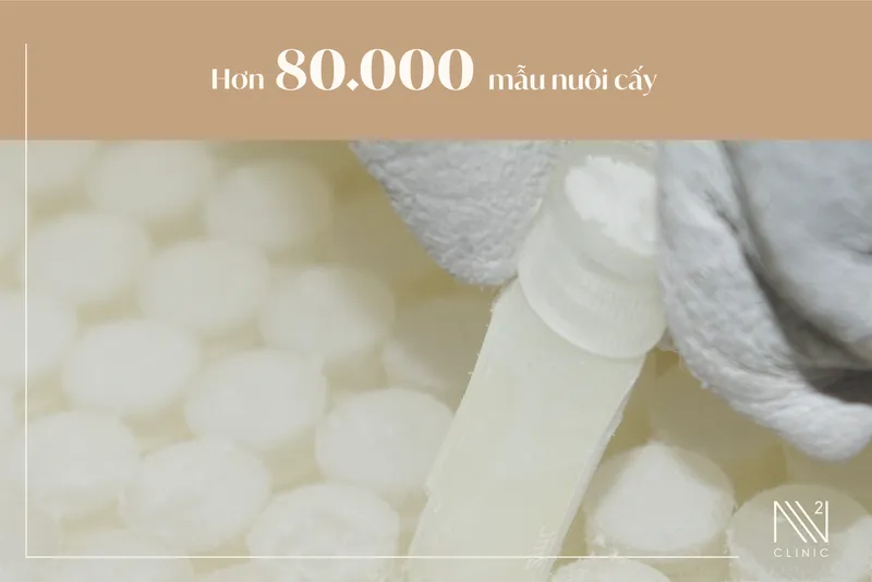 Sản phẩm Trung tam nuoi cay 02 scaled — Công Ty Cổ Phần Công Nghệ Y Học Tái Sinh Việt Nhật — MST 0109996597