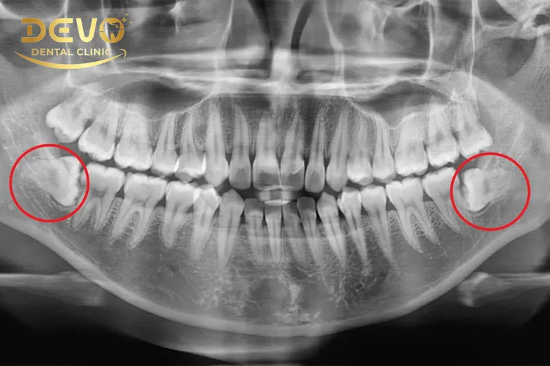 Sản phẩm nho rang khon gia bao nhieu 1 — Công Ty CP Tập Đoàn DEVO — MST 0110171826