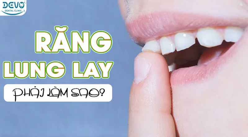 Sản phẩm rang lung lay — Công Ty CP Tập Đoàn DEVO — MST 0110171826