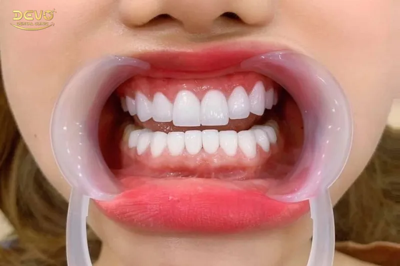 Sản phẩm boc rang su may ngay het dau — Công Ty CP Tập Đoàn DEVO — MST 0110171826