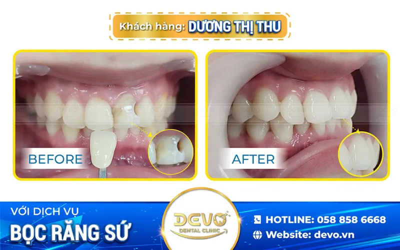 Sản phẩm duong thu rang su — Công Ty CP Tập Đoàn DEVO — MST 0110171826