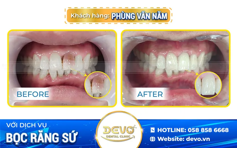 Sản phẩm khach rang su — Công Ty CP Tập Đoàn DEVO — MST 0110171826