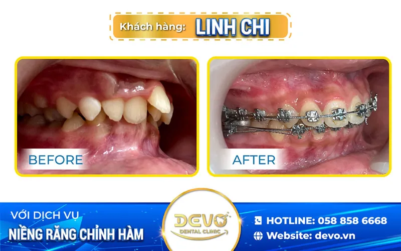Sản phẩm linh chi nieng — Công Ty CP Tập Đoàn DEVO — MST 0110171826