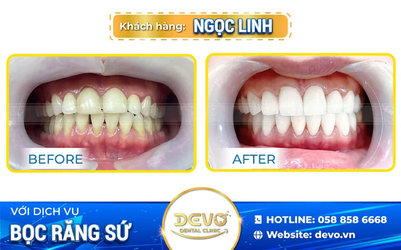 Sản phẩm ngoc linh rang su — Công Ty CP Tập Đoàn DEVO — MST 0110171826