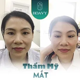 Sản phẩm tham my mat tai hai phong — Công Ty TNHH Thương Mại Dịch Vụ HOAVY — MST 0201703764