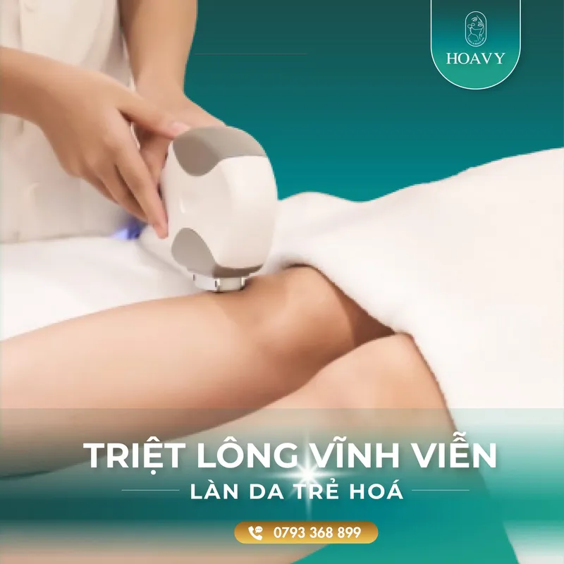 Sản phẩm thammyhoavy.vn dich vu ttriet long vinh vien tre hoa lan da triet long hai phong triet long quang ninh 2 scaled — Công Ty TNHH Thương Mại Dịch Vụ HOAVY — MST 0201703764