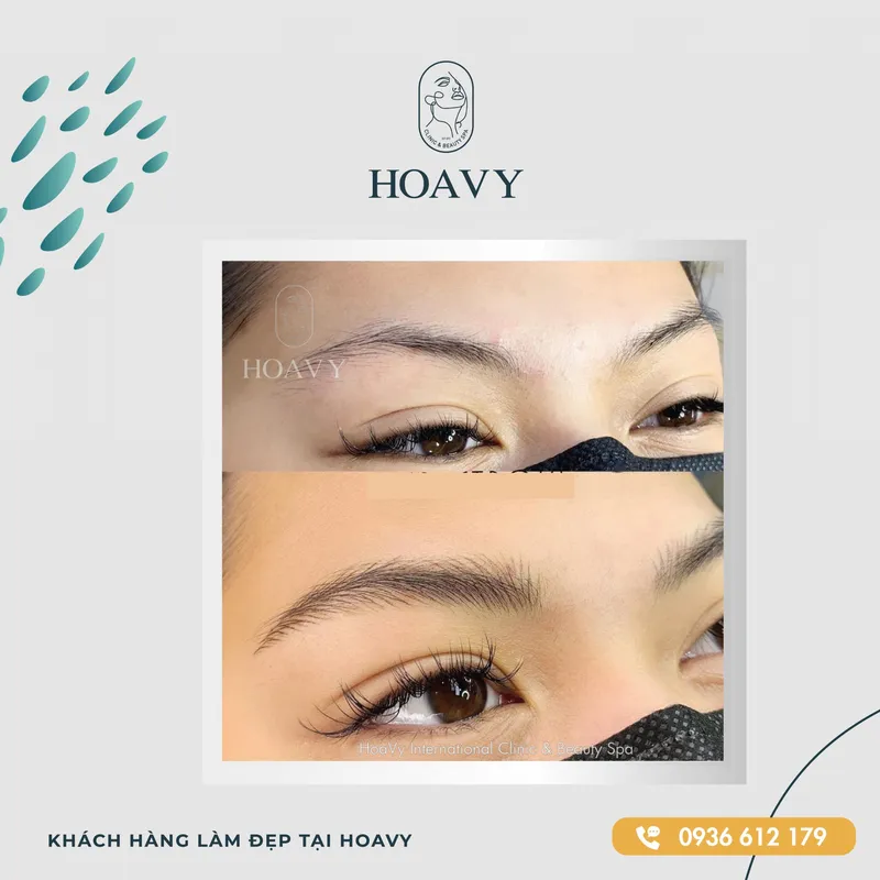 Sản phẩm thammyhoavy.vn hinh anh khach hang lam dep mat mi tai hoa vy hai phong quang ninh scaled — Công Ty TNHH Thương Mại Dịch Vụ HOAVY — MST 0201703764