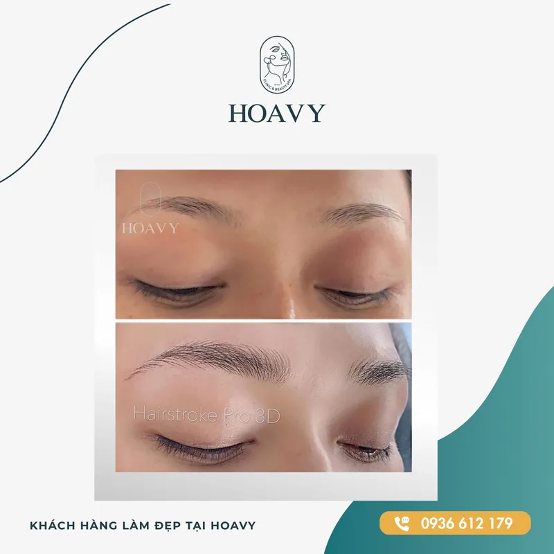 Sản phẩm thammyhoavy.vn hinh anh khach hang lam dep mat tai hoa vy hai phong quang ninh scaled — Công Ty TNHH Thương Mại Dịch Vụ HOAVY — MST 0201703764