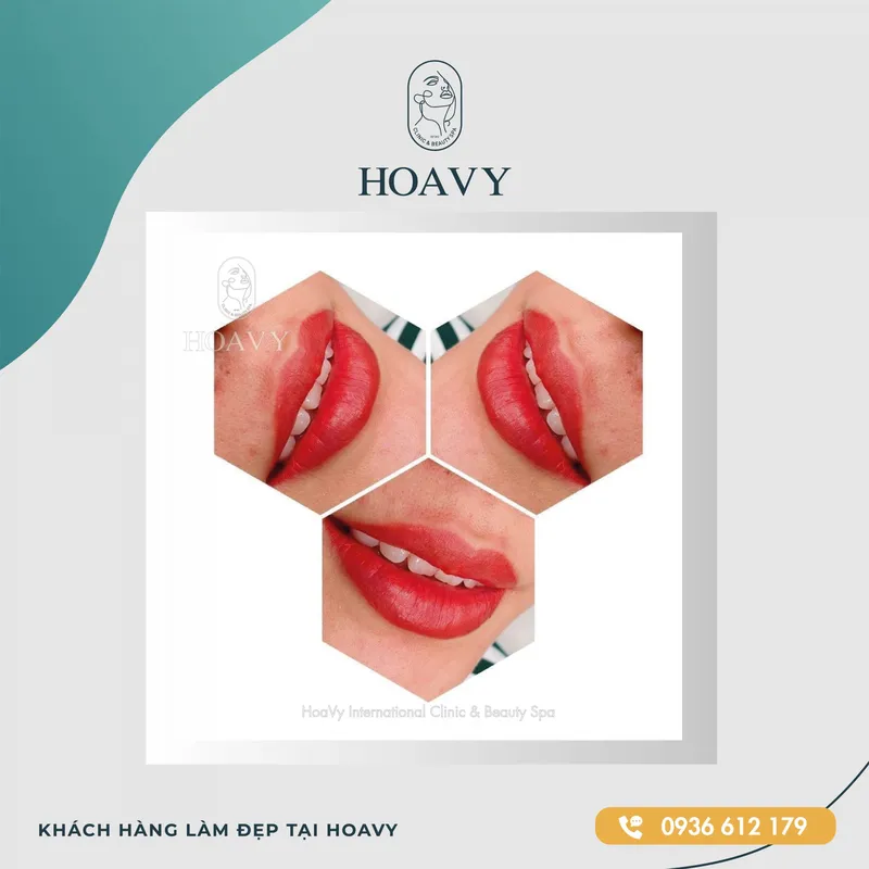 Sản phẩm thammyhoavy.vn hinh anh khach hang lam dep moi mieng tai hoa vy hai phong quang ninh scaled — Công Ty TNHH Thương Mại Dịch Vụ HOAVY — MST 0201703764