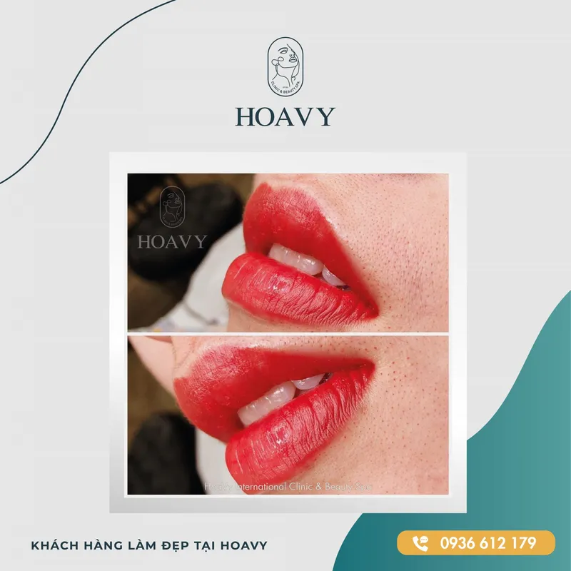 Sản phẩm thammyhoavy.vn hinh anh khach hang lam dep moi tai hoa vy hai phong quang ninh scaled — Công Ty TNHH Thương Mại Dịch Vụ HOAVY — MST 0201703764