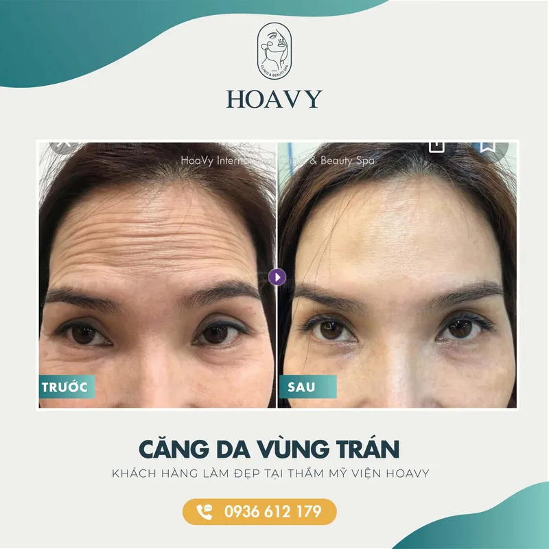 Sản phẩm thammyhoavy.vn hinh anh khach hang lam dep tai hoa vy hai phong quang ninh cang da vung tran scaled — Công Ty TNHH Thương Mại Dịch Vụ HOAVY — MST 0201703764