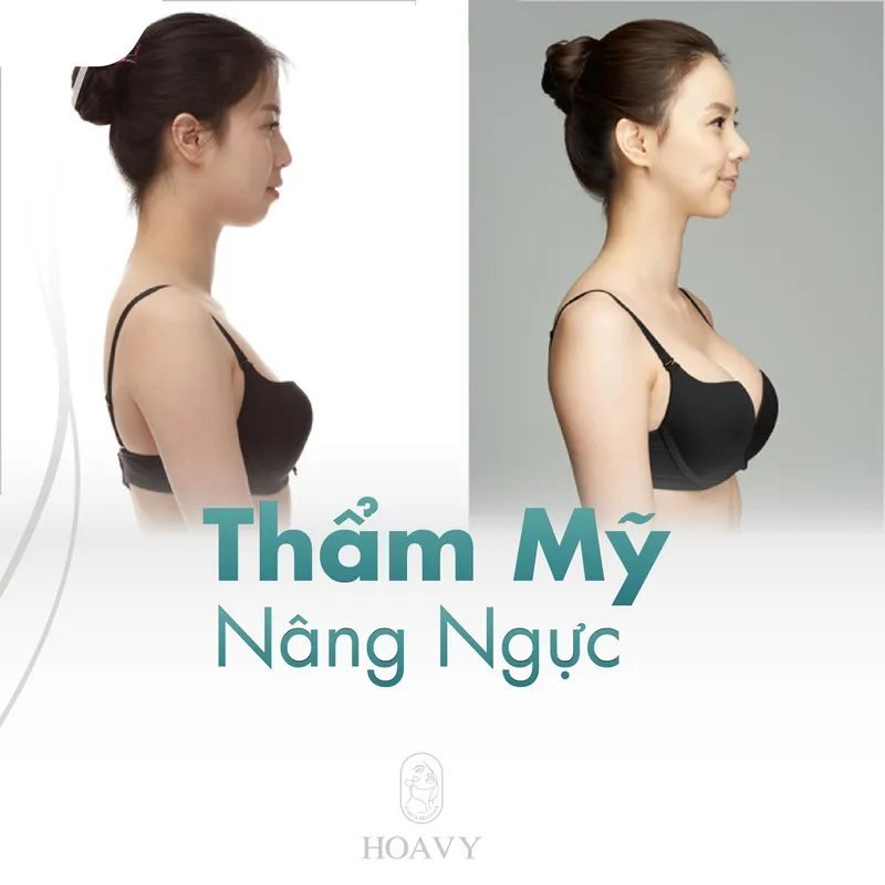 Sản phẩm thammyhoavy.vn hoa vy tham my nang nguc tai hai phong tham my nang nguc tai quang ninh — Công Ty TNHH Thương Mại Dịch Vụ HOAVY — MST 0201703764
