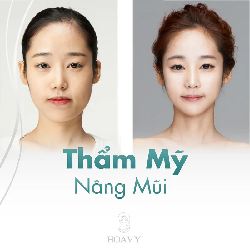 Sản phẩm thammyhoavy.vn tham my nang mui tai hai phong tham my nang mui tai quang ninh — Công Ty TNHH Thương Mại Dịch Vụ HOAVY — MST 0201703764