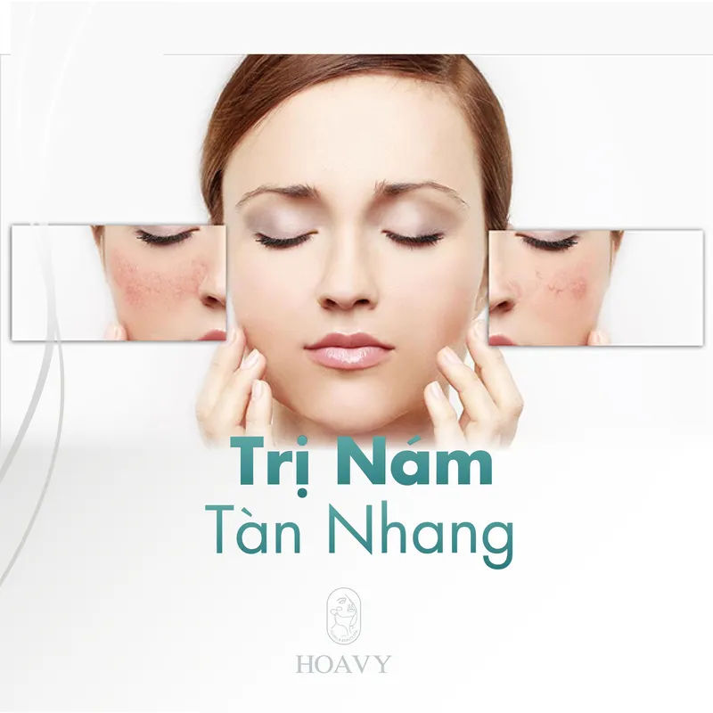 Sản phẩm thammyhoavy.vn tri nam tan nhang tai hai phong tri nam tan nhang tai quang ninh — Công Ty TNHH Thương Mại Dịch Vụ HOAVY — MST 0201703764