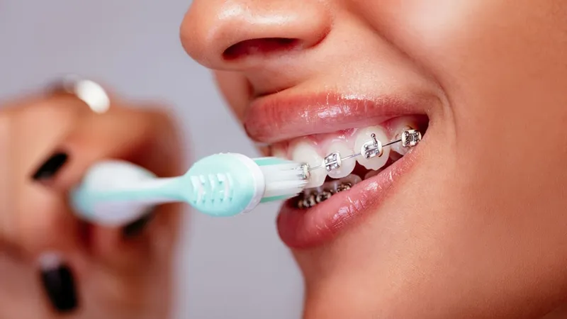 Sản phẩm electric toothbrushes for braces — COLGATE-PALMOLIVE - Công Ty TNHH COLGATE-PALMOLIVE (Việt Nam) — MST 0300546015