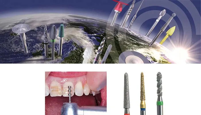 Sản phẩm NTI 1 — Nha Khoa D.O.E - Công Ty TNHH Trang Thiết Bị Nha Khoa — MST 0302130894