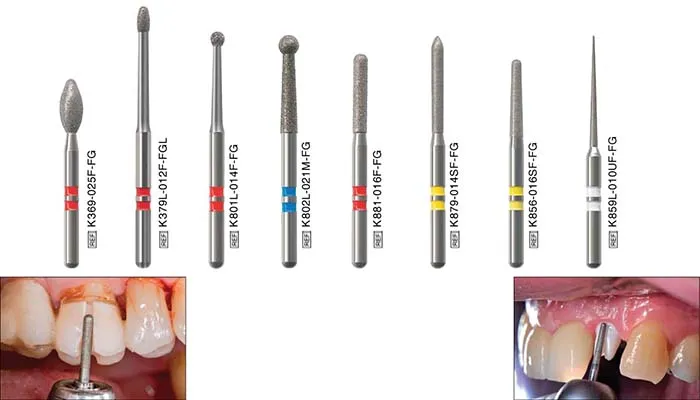 Sản phẩm NTI 3 — Nha Khoa D.O.E - Công Ty TNHH Trang Thiết Bị Nha Khoa — MST 0302130894