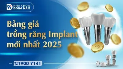Sản phẩm bang gia implant 400x225 — Nha Khoa Đông Nam — MST 0304132304
