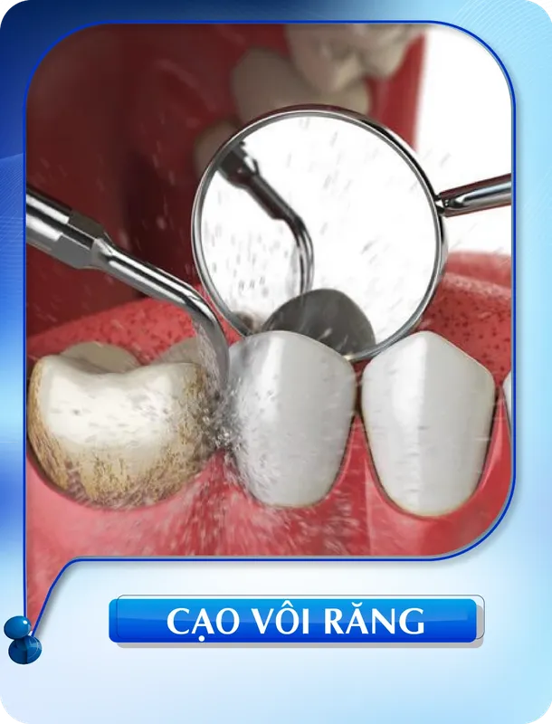 Sản phẩm cao voi rang — Nha Khoa Đông Nam — MST 0304132304