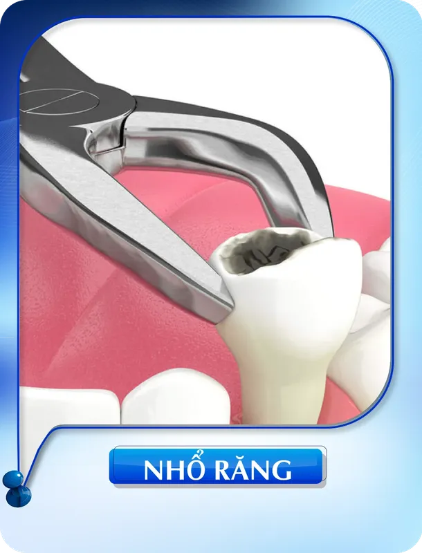 Sản phẩm nho rang 1 — Nha Khoa Đông Nam — MST 0304132304