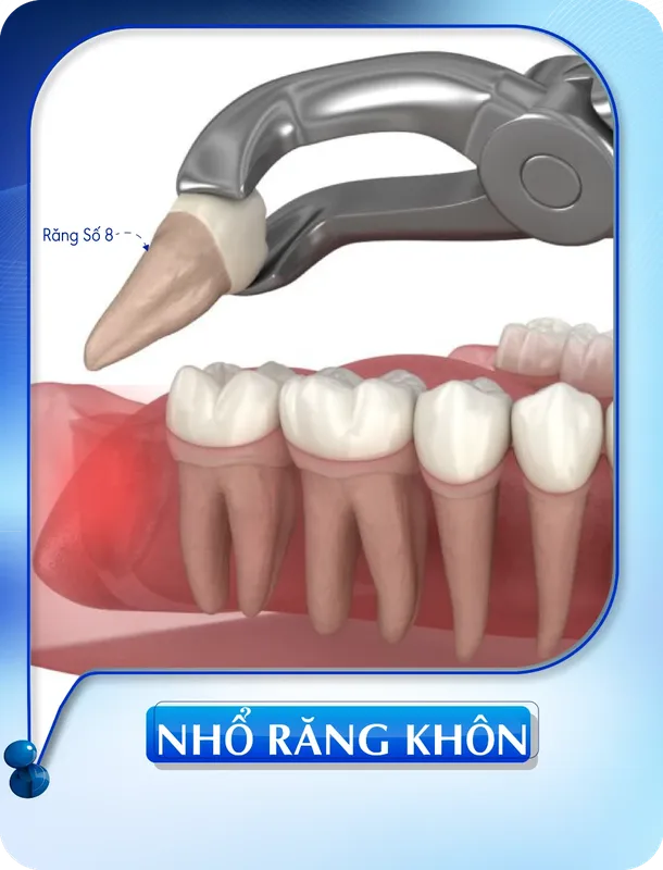 Sản phẩm nho rang khon — Nha Khoa Đông Nam — MST 0304132304