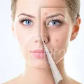 Sản phẩm Chăm sóc da mụn chuyên sâu và Trị mụn nền tảng — Viên Mỹ - Công Ty TNHH Thương Mại Và Dịch Vụ Viên Mỹ — MST 0304613079