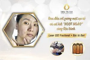 Sản phẩm bang gia dich vu tri seo ro an toan 300x200 — Trung Tâm Thẩm Mỹ Miss Trâm — MST 0305993715