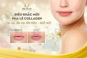 Sản phẩm bang gia dieu khac moi pha le hcm 300x200 — Trung Tâm Thẩm Mỹ Miss Trâm — MST 0305993715