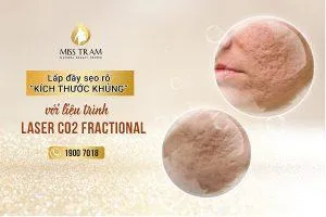 Sản phẩm bang gia dieu tri seo hieu qua hcm 300x200 — Trung Tâm Thẩm Mỹ Miss Trâm — MST 0305993715
