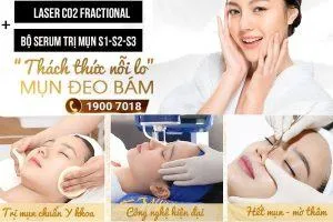 Sản phẩm cac phuong phap dieu tri mun hieu qua 300x200 — Trung Tâm Thẩm Mỹ Miss Trâm — MST 0305993715