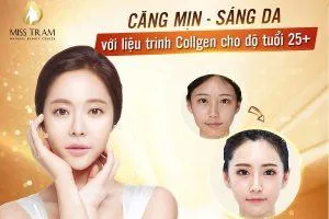 Sản phẩm dich vu cham soc da bang collagen hcm 300x200 — Trung Tâm Thẩm Mỹ Miss Trâm — MST 0305993715